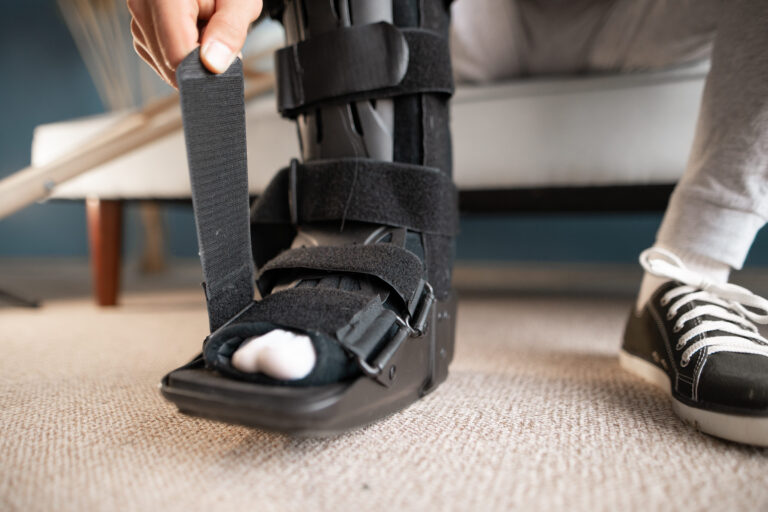 Sofortige aktive Bewegung oder kurze Immobilisation?